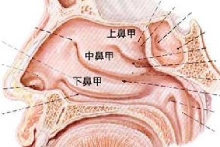 (貴陽哪個(gè)醫(yī)院對鼻中隔偏曲治療較好)貴陽哪個(gè)醫(yī)院看鼻最好(圖2)