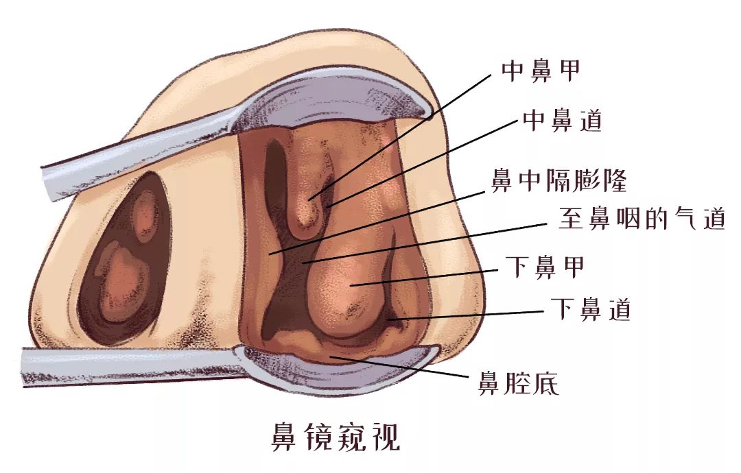 鼻甲肥大引起的呼吸困難怎么辦？(圖2)