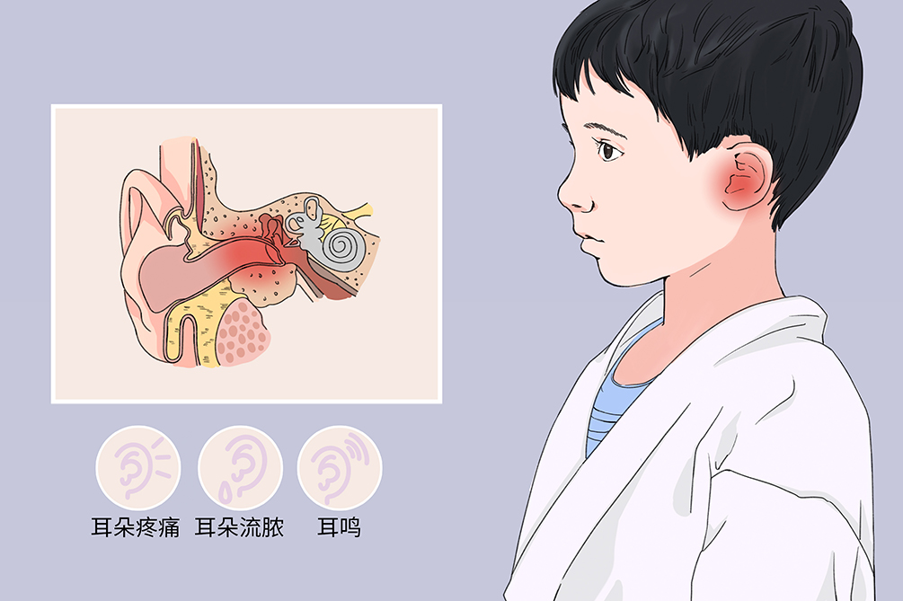 中耳炎雖小，但其危害不容小覷！(圖1)