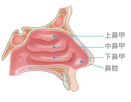 鼻甲肥大會引起面部結(jié)構(gòu)變化，還會導致眼袋、黑眼圈？(圖1)